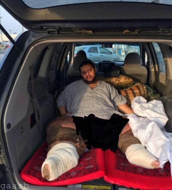 الأمير محمد بن سلمان يتكفل بنقل المريض تركي الغامدي إلى ألمانيا