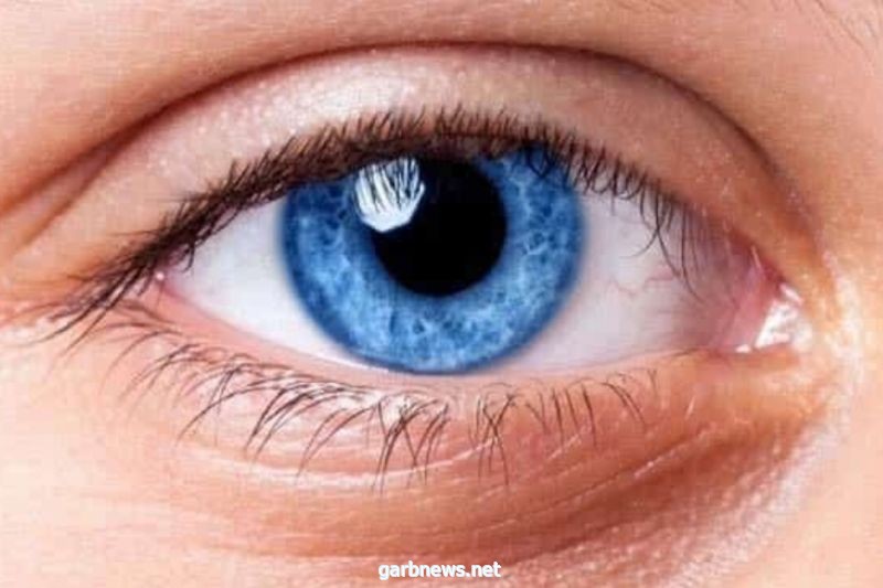 تغيير لون الأعين خطر يهدد البصر