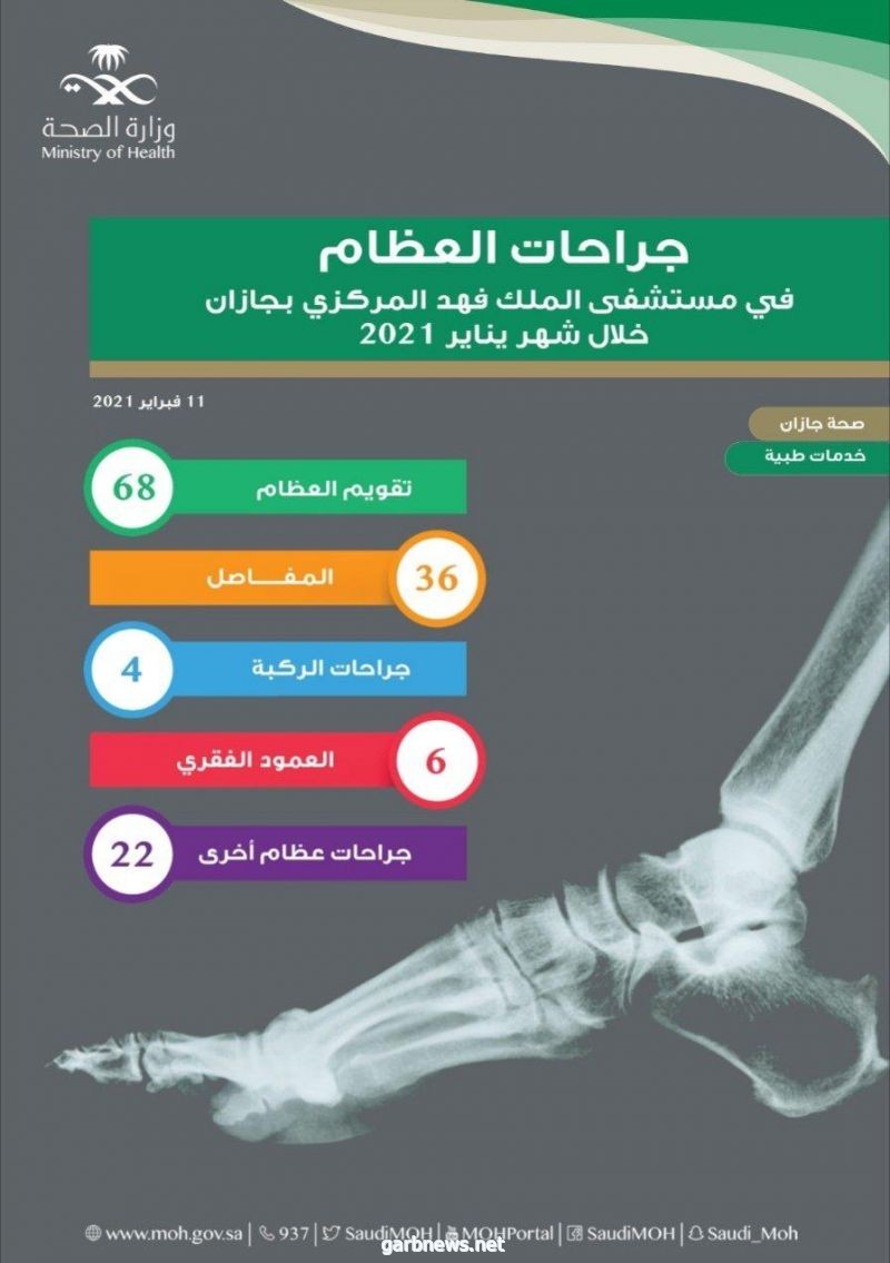 إجراء “154” عملية جراحة عظام بمستشفى الملك فهد المركزي بجازان