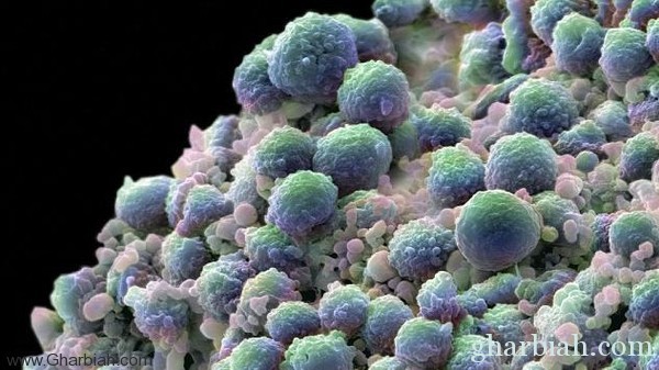 اكتشاف 13 جيناً مسبباً لأعنف أنواع سرطان البروستات