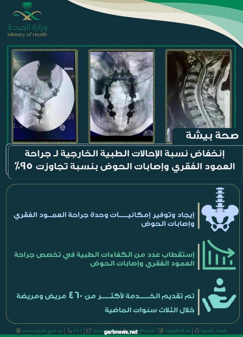 صحة بيشة :انخفاض نسبة الإحالات الطبية الخارجية   لـ جراحة العمود الفقري وإصابات الحوض  بنسبة تجاوزت 95