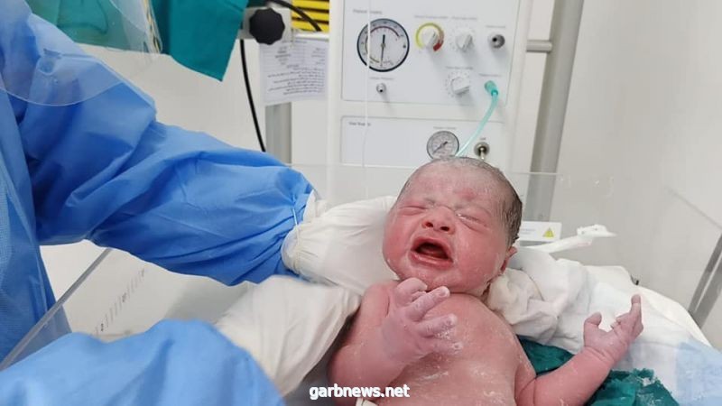 ولادة طفل بحالة نادرة وغامضة تمنعه من البكاء!