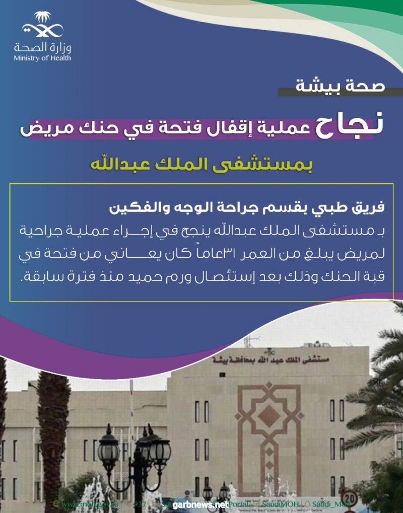 صحة بيشة : نجاح عملية إقفال فتحة في حنك مريض بمستشفى الملك عبدالله