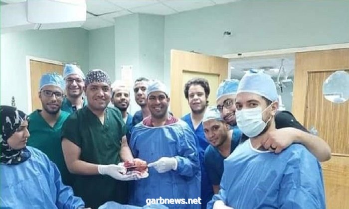 استئصال ورم يزن 7 كيلوغرامات من خصية شاب عشريني بصعيد #مصر