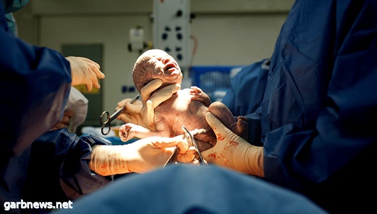 في حالة طبية طارئة .. ولادة قيصرية ناجحة لأم تعاني من عدم فتح عنق الرحم