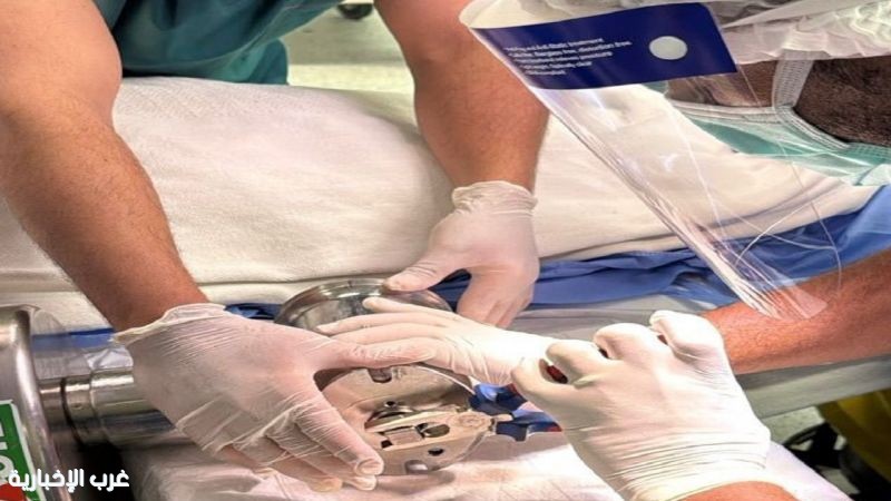 #الدفاع المدني بــ #بريدة يحرر يد شخص علقت في فرامة