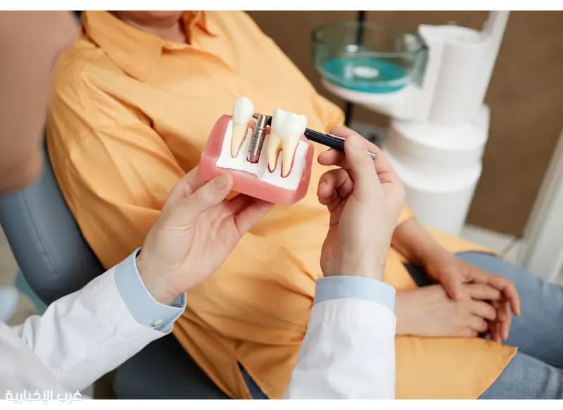 زراعة الأسنان الفورية أم التقليدية؟ د. هاني موسى يوضح الخيار الأنسب لكل حالة