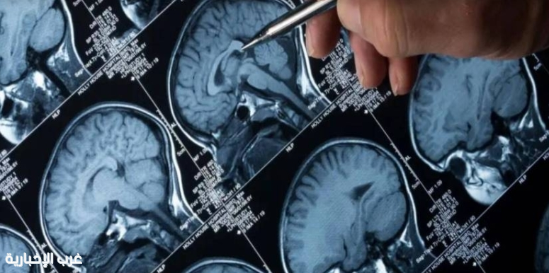 أستراليا تطلق تجربة سريرية رائدة لعلاج أورام الدماغ لدى الأطفال