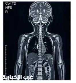 في أقل من ساعة.: الرنين الشامل للأطفال يعزز خدمات "تجمع الطائف الصحي #الطائف في أقل من ساعة.: الرنين الشامل للأطفال يعزز خدمات "تجمع الطائف الصحي #الطائف