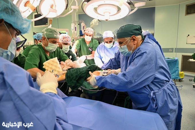 نجاح عملية فصل التوأم الملتصق المغربي "سجى وضحى"