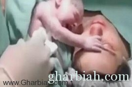 طفل يرفض الانفصال عن أمه بعد ولادته في مشهد مؤثر! " فيديو "