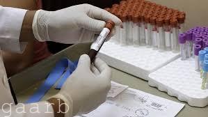 كوريا الجنوبية تؤكد أول إصابة بفيروس "زيــكـا"