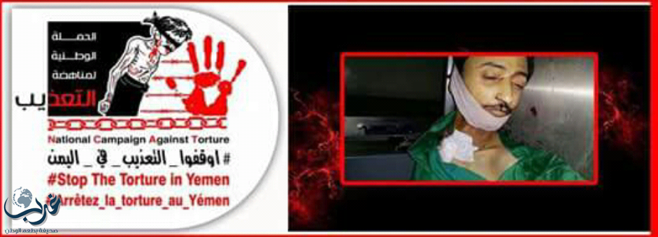 اليمن : توثيق 36 حالة وفاة لمختطفين لدى ميليشيا الحوثي والمخلوع