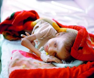 أكثر  من 21 مليون يمني يواجهون خطر الملاريا