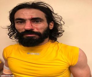 إصابة حسين عبدالغني إثر اشتباك مع حسن معاذ بعد المباراة