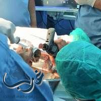 مدني جدة: ينقذ يد طفل من داخل فرامة اللحم