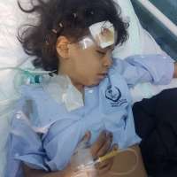 ‏مقذوف حوثي يصيب امرأة يمنية وطفلتين سعوديتين بالعارضة