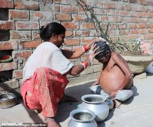 انتفاخ بطن صبي يحير الأطباء في الهند