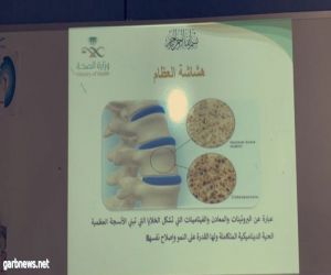 الشؤون الصحية المدرسية بتعليم مكة تطلق فعاليات اليوم العالمي للتوعية بهشاشة العظام