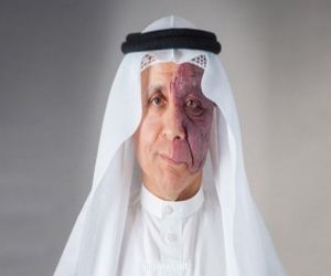 "القويز" يثمّن أمر الملك بتحمُّل الحكومة 60 % من رواتب موظفي القطاع الخاص السعوديين