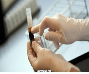 استراليا  : 130 متطوعا فى اختبار لقاح مضاد لفيروس كورونا
