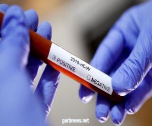خبراء منظمة الصحة العالمية: احتمالية تسرب فيروس كورونا من معمل ووهان مستبعدة للغاية