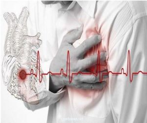 "استشاري" يكشف عن أهم أسباب حدوث جلطة القلب الحادة وكيف يمكن تفاديها