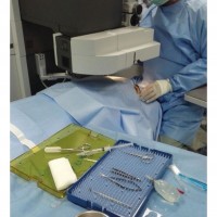 إجراء أول عملية تصحيح للنظر بالليزر بمستشفى بريدة المركزي بقيادة الاصقة