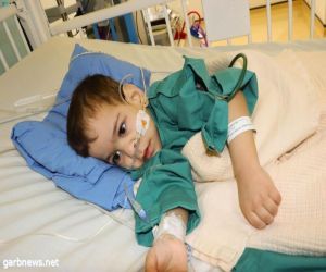 الفريق الطبي يؤكد استقرار الحالة الصحية للتوأم السيامي السوري "بسام" بعد أسبوع من عملية فصله