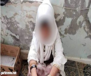 جريمة هزت اليمن.. أسرة عذبت طفلتها ثم باعتها كجارية