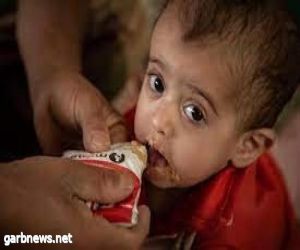 الأمم المتحدة تحذر: 30 % من العرب مهددون بالجوع