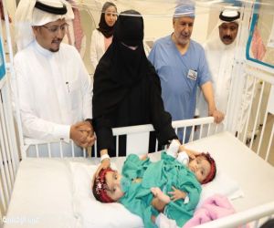 الدكتور عبدالله الربيعة يُعلن نجاح عملية فصل التوأم السعودي الملتصق "يارا ولارا"