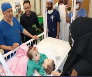 نجاح عملية فصل التوأم الملتصقين السوري "سيلين وإيلين"