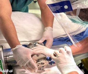 #الدفاع المدني بــ #بريدة يحرر يد شخص علقت في فرامة