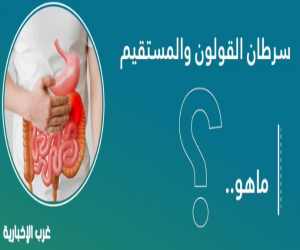 فهد الطبية توضح الأعراض المبكرة لسرطان القولون وعوامل الإصابة به