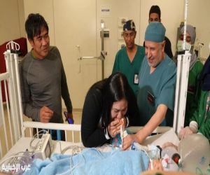 في إنجاز طبي جديد.. نجاح عملية فصل التوأم الملتصق الفلبيني (أوليفيا وجيانا) بعد 6 ساعات