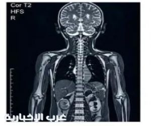 في أقل من ساعة.:  الرنين الشامل للأطفال يعزز خدمات "تجمع الطائف الصحي #الطائف