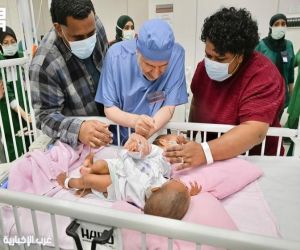 بتوجيهات القيادة الكريمة .. بدء فصل التوأم الملتصق الفيجي بالرياض