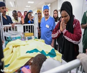 نجاح عملية فصل التوأم الملتصق التنزاني (لايتيينس ولوفنس)