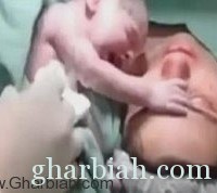 طفل يرفض الانفصال عن أمه بعد ولادته في مشهد مؤثر! " فيديو "