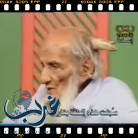 بالفيديوا : رجل من اليمن له قرون في رأسه