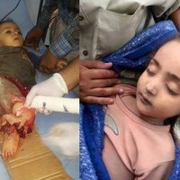 مقتل وإصابة 13 يمنيا بينهم نساء وأطفال في قصف للمليشيا الحوثية بمدينة تعز