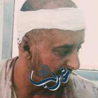 اليمن: إصابة مصور قناة سهيل بشظايا قذيفة حوثية في نهم