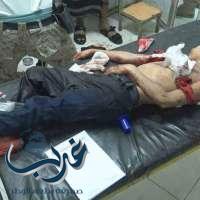 رصدلحقوق الإنسان في اليمن: تصدر بيان إدانة للمجازر التي أرتكبتها ميليشيا الإنقلاب في الأحياء السكنية بمحافظة بتعز