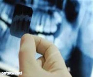 علماء أوروبيون:يبدأون العمل بأقوى أشعة سينية "X ray"في العالم لتطوير مجال رصد الفيروسات