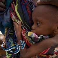 اليونسيف: 75 ألف طفل قد يموتون جوعاً في نيجيريا