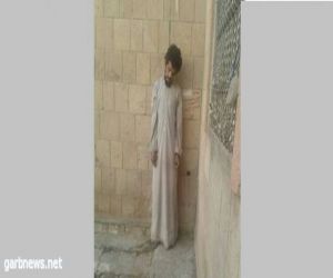 انتحار مختطف في سجن الحوثيين بمدينة رداع