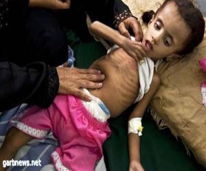 تلاعب الحوثي بالإغاثة يهدد عشرات الأطفال بالموت