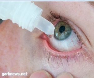 التهاب ملتحمة العين.. الأعراض والعلاج
